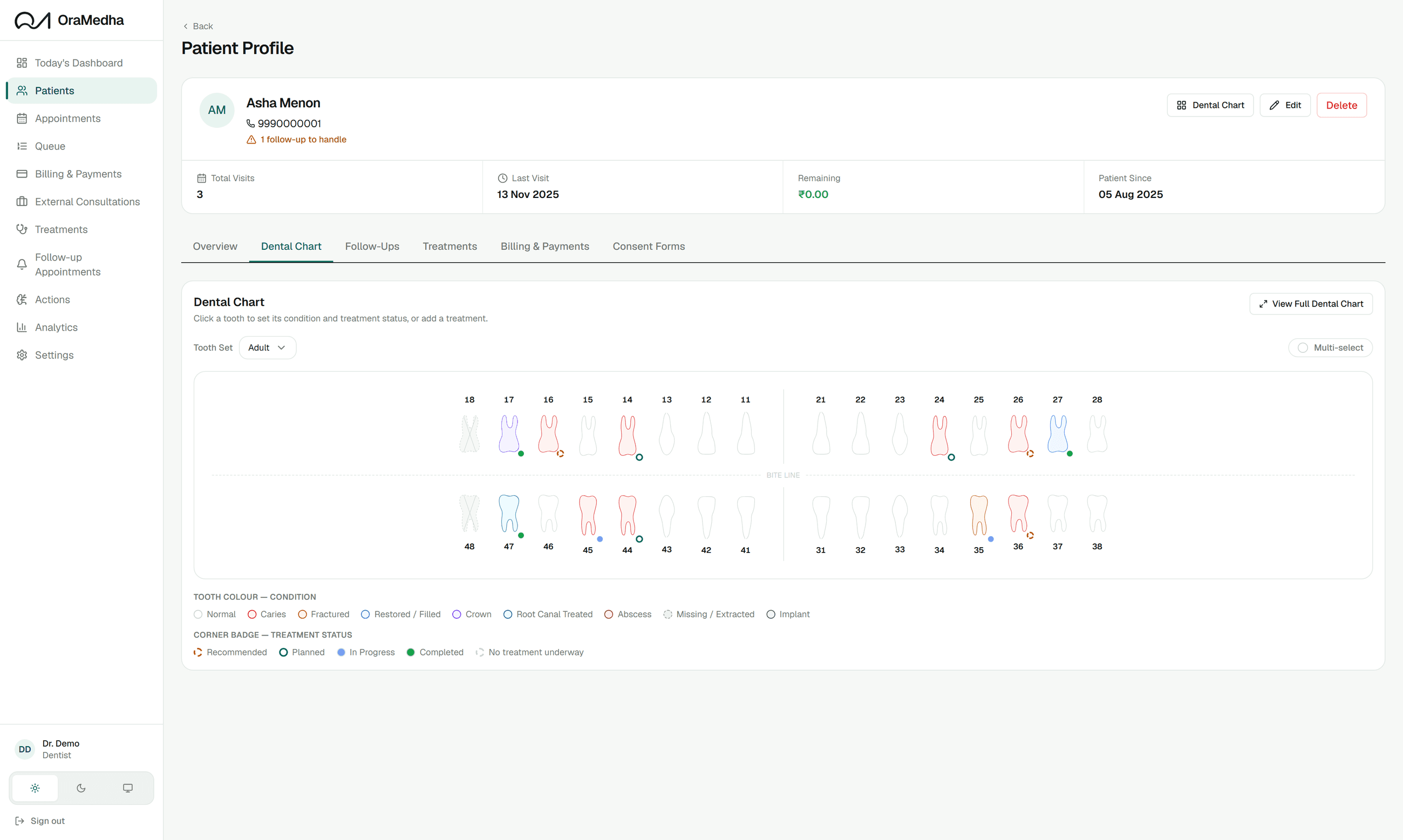 A patient record and dental chart in OraMedha, with per-tooth treatment status